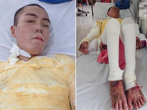Vừa hút thuốc vừa sửa bình xăng xe máy, người đàn ông hóa