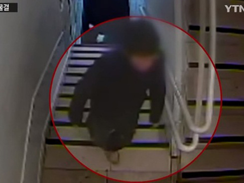 Mắc bệnh lạ gây trẹo cổ 90 độ, bé gái phải chịu đựng nỗi đau hàng ngày vì gia đình không đủ tiền chữa trị-4