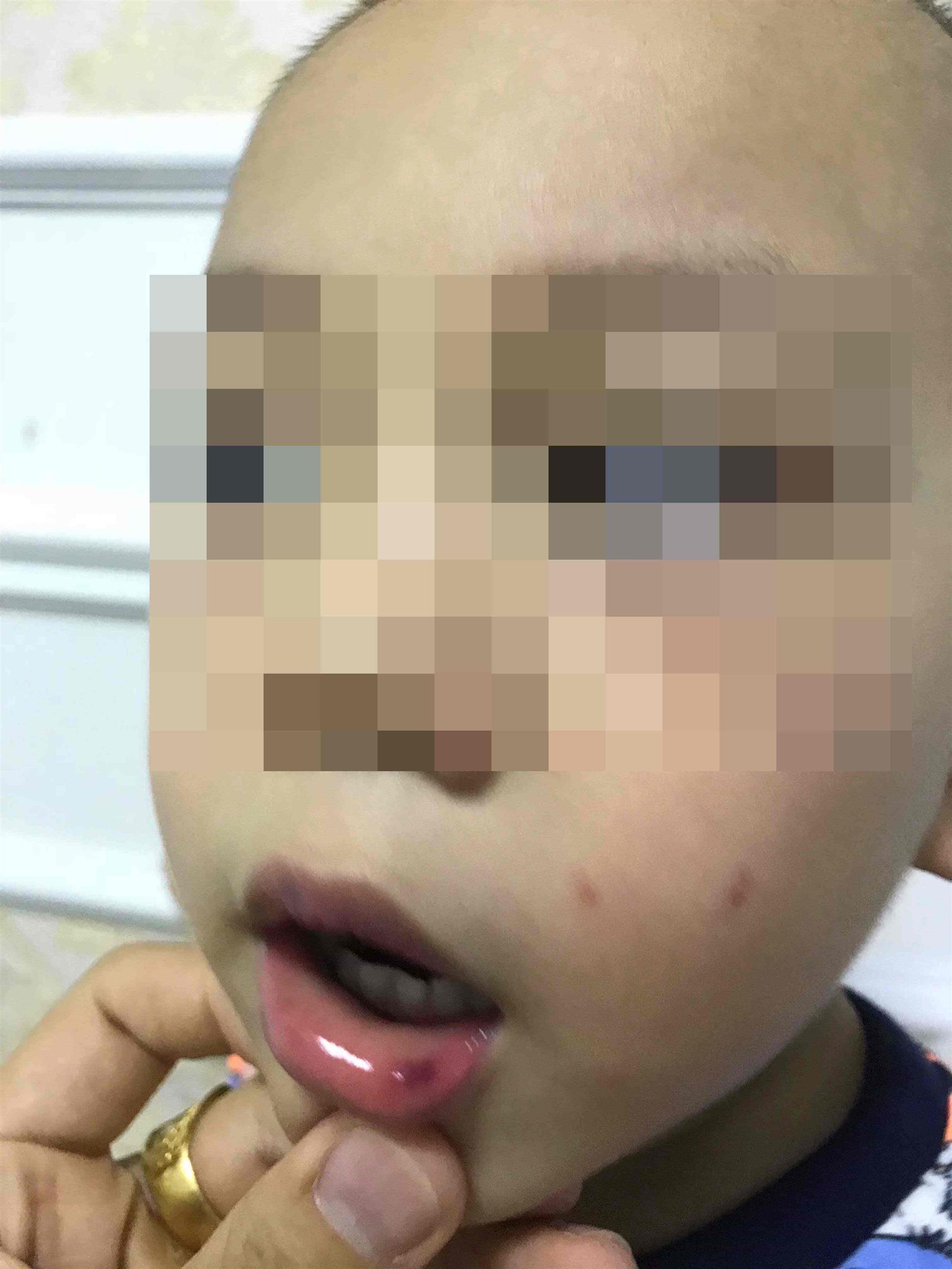 Lá thư xin lỗi gửi lúc đêm muộn của cô giáo ở Hà Nội tát bé hơn 2 tuổi sấp mặt, tụ máu môi-1