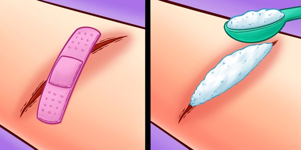 10 mẹo sơ cứu nhất định phải biết, có thể giúp bạn thoát chết trong gang tấc-10