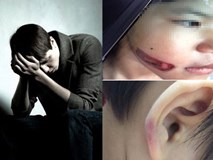 Về nhà đột ngột giữa trưa sau chuyến công tác, tôi chết đứng khi thấy con gái nằm trên giường với những vết thương hằn đỏ và gương mặt đẫm nước mắt Về nhà đột ngột giữa trưa sau chuyến công tác, tôi chết đứng khi thấy con gái nằm trên giường với những vết thương hằn đỏ và gương mặt đẫm nước mắt