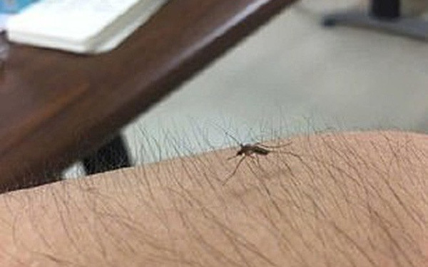 Các thiếu nữ  thi nhau khoe lông tay, lông chân dày đến mức muỗi cũng không đốt nổi-1
