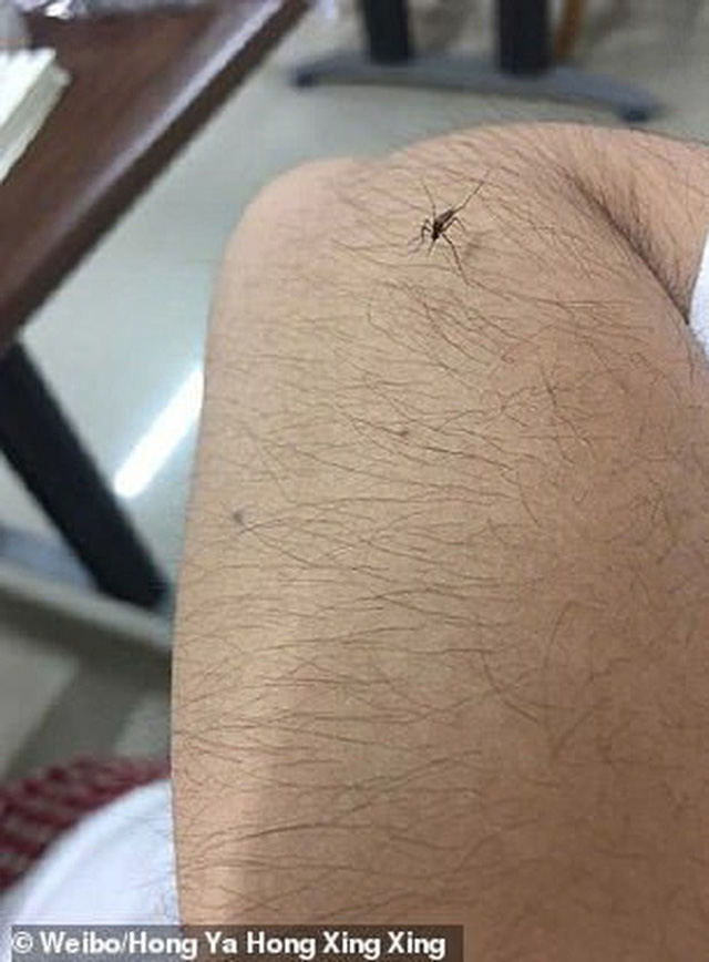 Các thiếu nữ  thi nhau khoe lông tay, lông chân dày đến mức muỗi cũng không đốt nổi-5