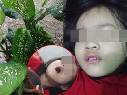 Bé gái 4 tuổi bị co giật, sưng môi, nguy hiểm tính mạng vì cắn phải lá của loại cây mà hầu như nhà nào cũng trồng trong nhà