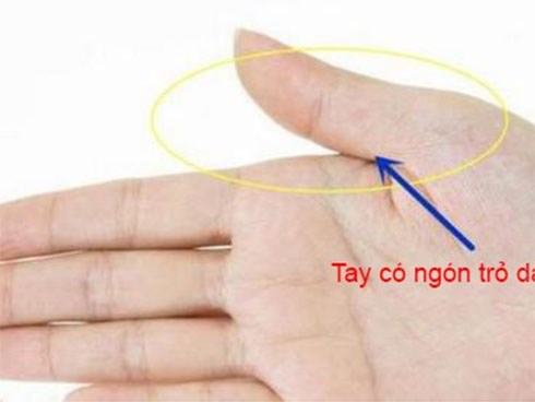 Phụ nữ sở hữu tướng tay này, càng lớn tuổi càng có nhiều phúc khí, sau 40 tuổi trời định mang mệnh thiếu phu nhân, giàu có viên mãn