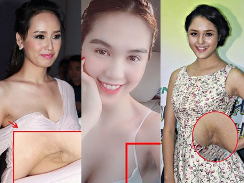 Đâu chỉ riêng Ngọc Trinh, nhiều mỹ nhân Việt xinh tuyệt đỉnh nhưng vùng nách thâm đen lại không thể giấu đâu cho kỹ