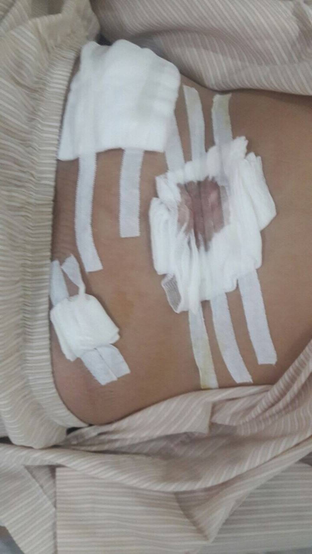 Được đặc cách, nữ thí sinh vừa mổ ruột thừa vẫn quyết tâm dự thi THPT Quốc gia-1