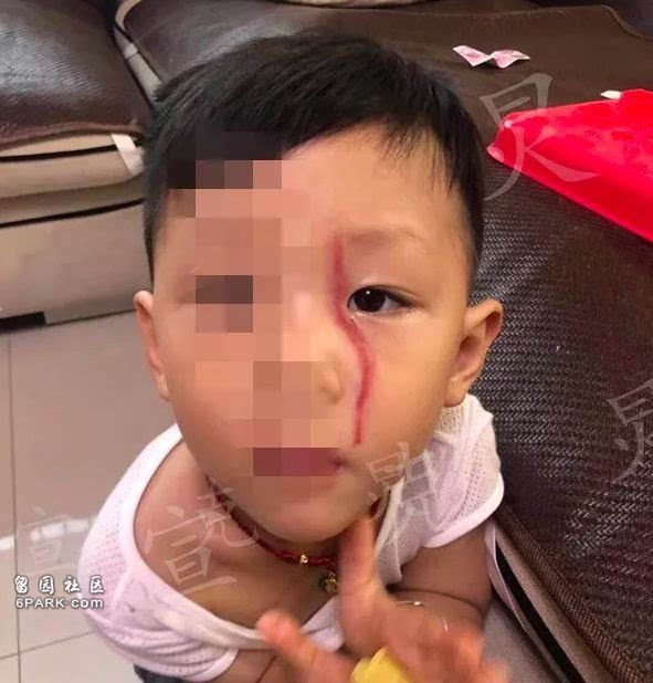 Khoảnh khắc gây sốc: Dắt cháu trai 3 tuổi đi thang máy, bà hoảng hồn phản ứng nhanh cứu mạng cháu bị chó dữ khổng lồ nhảy lên cắn xé-5