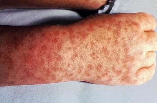 10 thay đổi trên da tố cáo bạn đang mắc bệnh, càng để lâu càng nguy hiểm đến tính mạng-1