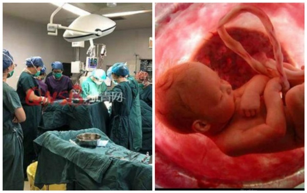 Thai phụ 34 tuần mất con chỉ vì một sơ suất nhỏ khiến ôm hận cả đời, hối hận cũng không kịp-1