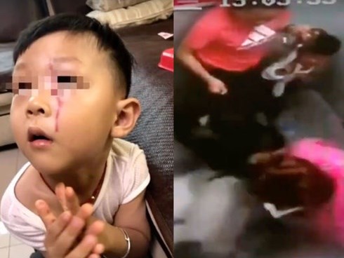 Bé trai bị chó khổng lồ tấn công trong thang máy