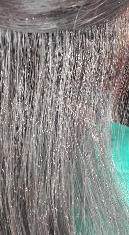 Rùng mình với tổ chấy hàng nghìn con tranh nhau làm tổ trưởng trên đầu bé gái-1