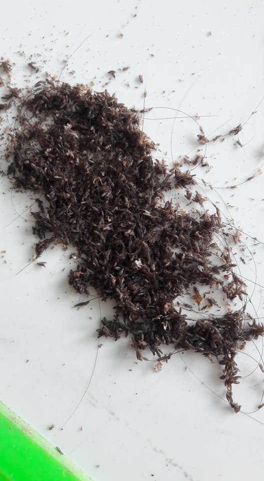 Rùng mình với tổ chấy hàng nghìn con tranh nhau làm tổ trưởng trên đầu bé gái-3