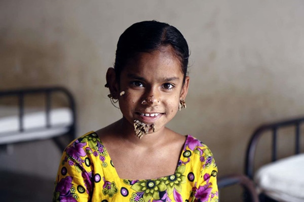 Cuộc sống bế tắc của những người bị mọc rễ cây-2