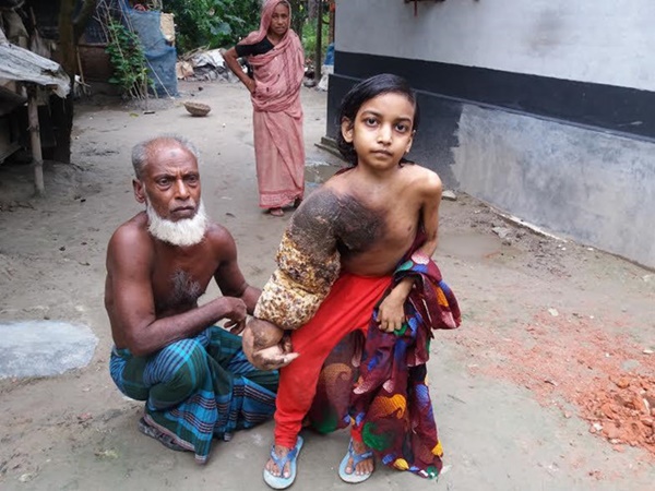 Cuộc sống bế tắc của những người bị mọc rễ cây-3