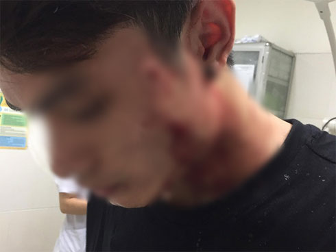 Clip: Nhóm người đàn ông lao vào hành hung một cô gái tại chung cư-1