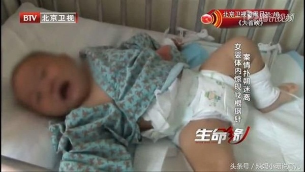 Vụ án bé gái 10 tháng tuổi bị 12 cây kim đâm vào người: Thủ phạm là người thân và nguyên nhân được đồn thổi khiến ai cũng rùng mình-4