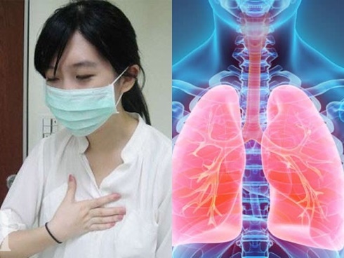 Ho kéo dài, chàng kiến trúc sư 27 tuổi chủ quan bỏ qua, đến lúc đau ngực mới đi khám thì đã bị ung thư phổi-4