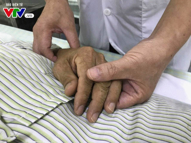 Sai lầm khi tránh nắng mùa hè, nhiều người bị méo miệng, liệt mặt-3