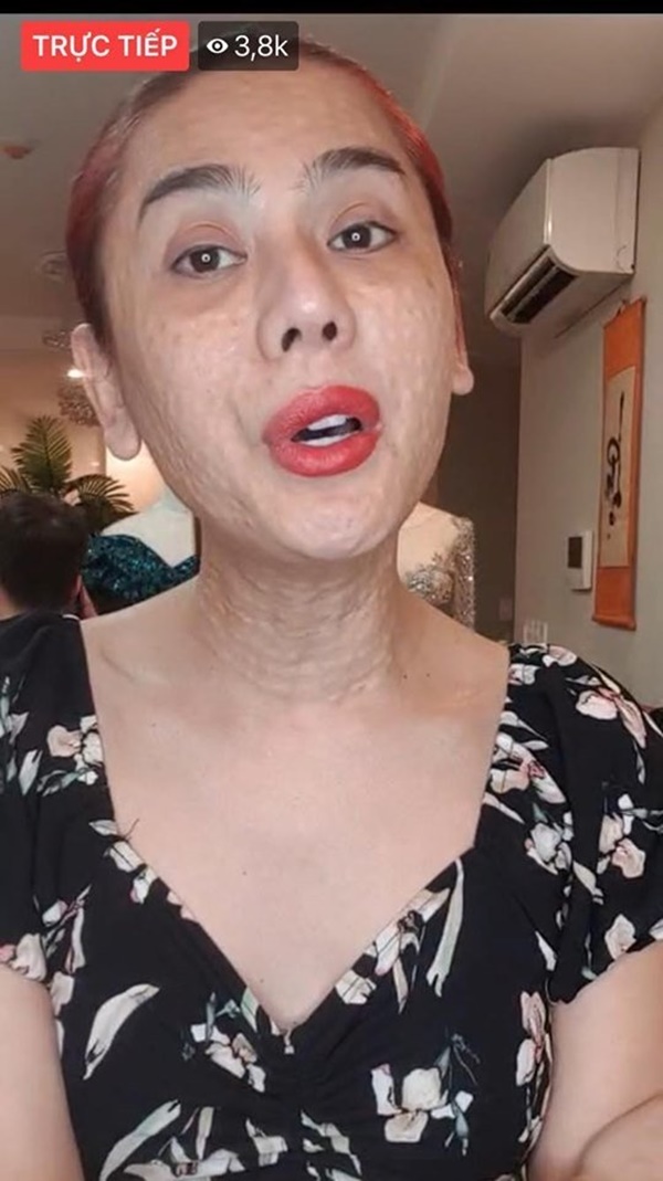 Bất ngờ với gương mặt chi chít nốt sần của Lâm Khánh Chi-2