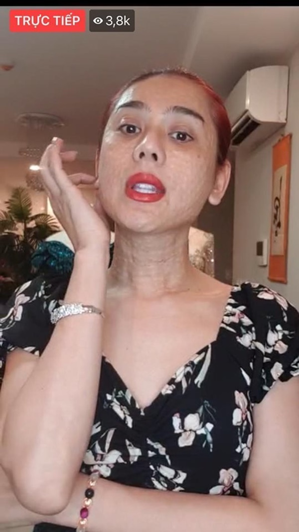 Bất ngờ với gương mặt chi chít nốt sần của Lâm Khánh Chi-3