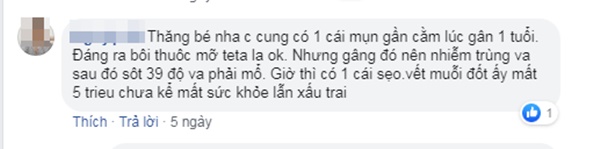 Trẻ 3 tuổi sốt cao, nhiễm trùng máu vì tự ý nặn mụn: Bác sĩ cảnh cáo 4 sai lầm bố mẹ hay làm có thể mất con-2