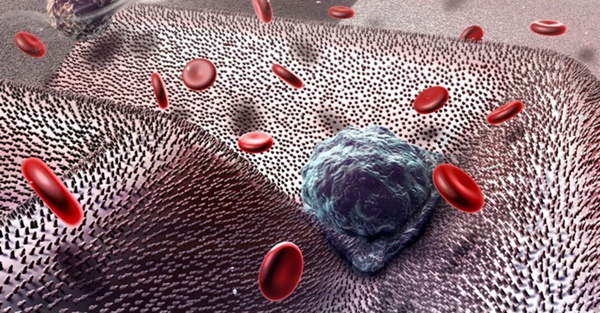 Dùng vitamin theo cách này là ngầm giúp tế bào ung thư di căn khắp cơ thể-2