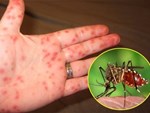Việc cần làm để phòng bệnh sốt xuất huyết khi hàng nghìn ổ dịch bùng phát ở miền Nam, cả nước có 6 trường hợp tử vong-5