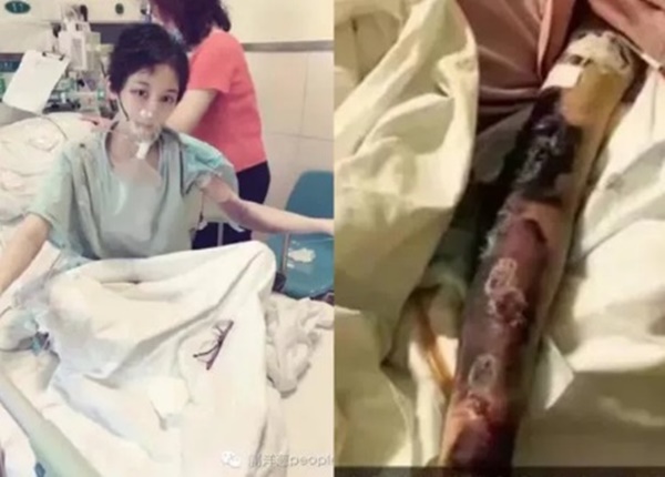 Nữ diễn viên xinh đẹp phim Tây Thi bí sử mất mạng vì điều trị ung thư sai cách-2