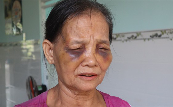 Con dâu đóng sập cửa đánh mẹ chồng sưng mặt rồi lại ngồi xuống khóc lóc xin lỗi-1