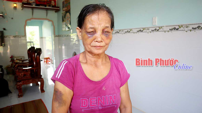 Con dâu đóng sập cửa đánh mẹ chồng sưng mặt rồi lại ngồi xuống khóc lóc xin lỗi-2