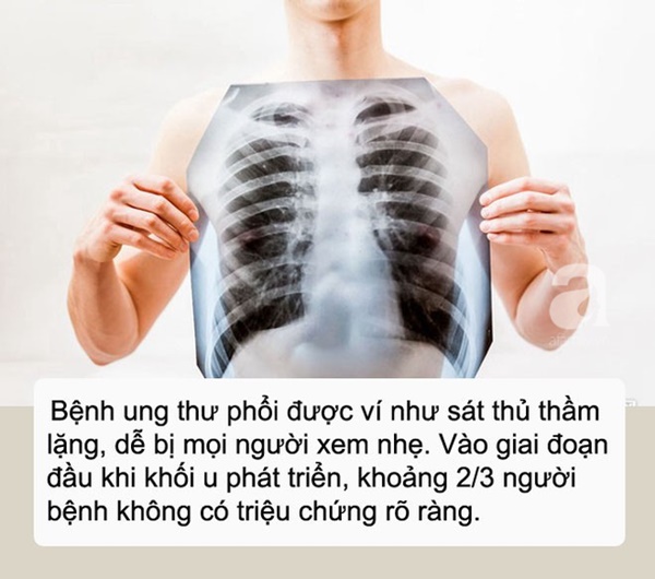 Ho kéo dài, chàng kiến trúc sư 27 tuổi chủ quan bỏ qua, đến lúc đau ngực mới đi khám thì đã bị ung thư phổi-1