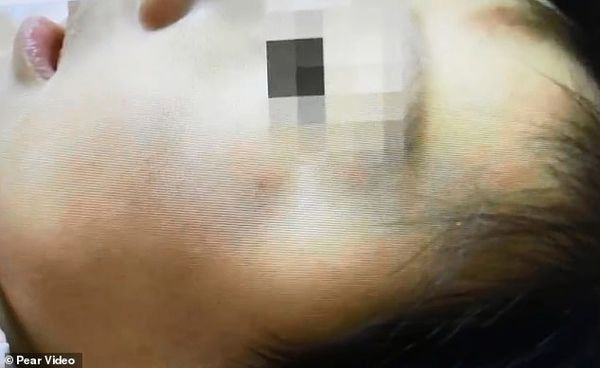 Phẫn nộ bảo mẫu tát, ôm siết chặt bé gái 7 tháng tuổi và lời xin lỗi muộn màng-2