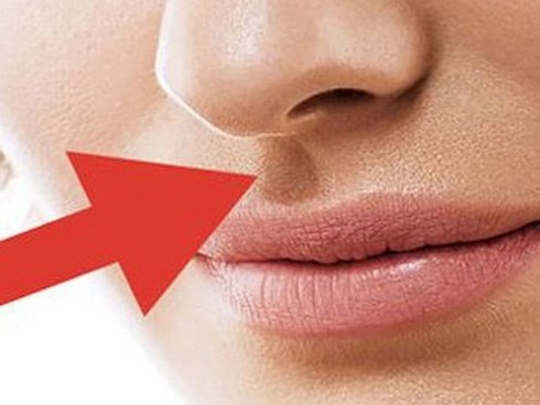 Xem đường nhân trung đoán số giàu sang hay nghèo hèn: Nếu thuộc kiểu số 3, xin chúc mừng!