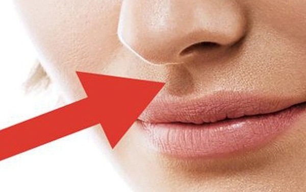 Xem đường nhân trung đoán số giàu sang hay nghèo hèn: Nếu thuộc kiểu số 3, xin chúc mừng!-1