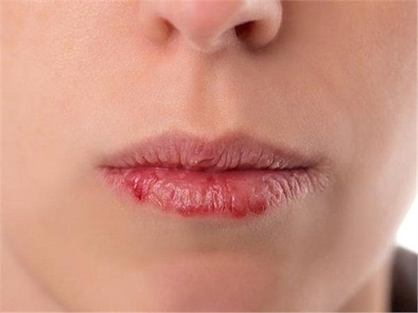 Xem đường nhân trung đoán số giàu sang hay nghèo hèn: Nếu thuộc kiểu số 3, xin chúc mừng!-2