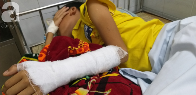 Nồi áp suất nổ tung gây bỏng, mẹ đưa 2 con đi chữa thầy lang thì hoại tử nặng, nguy cơ mất bộ phận sinh dục-3