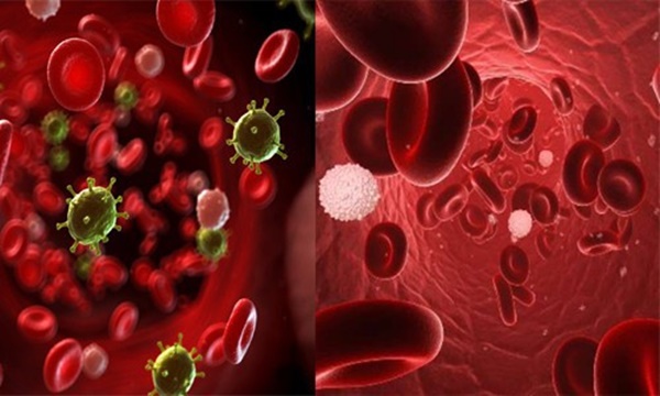 Nữ diễn viên xinh đẹp Tân dòng sông ly biệt chết vì ung thư máu, chuyên gia chỉ rõ dấu hiệu cần khám sớm-3