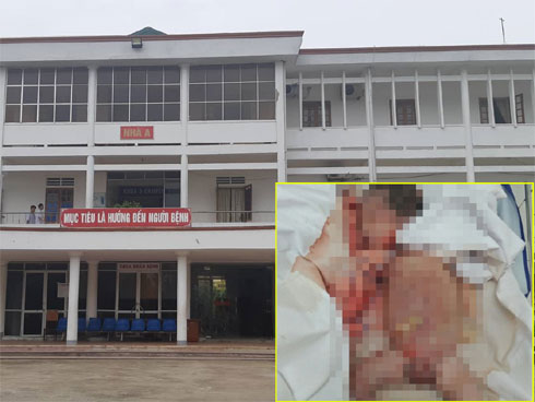 Thai 9 tháng chết lưu trong bụng mẹ do suy dinh dưỡng-2