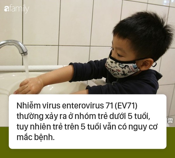 Bé trai 7 tuổi tê liệt cơ mặt sau 2 ngày sốt do nhiễm một loại virus gây bệnh thường gặp ở trẻ nhỏ-1