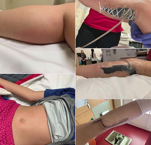 Nhiều người gặp nạn do vi khuẩn ăn thịt người tấn công: Đây là cách phòng tránh đúng nhất-3