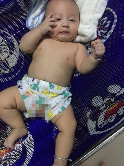 Lên cơn co giật rồi hôn mê, cô gái Yên Bái tỉnh dậy ngỡ ngàng phát hiện đã sinh con-6