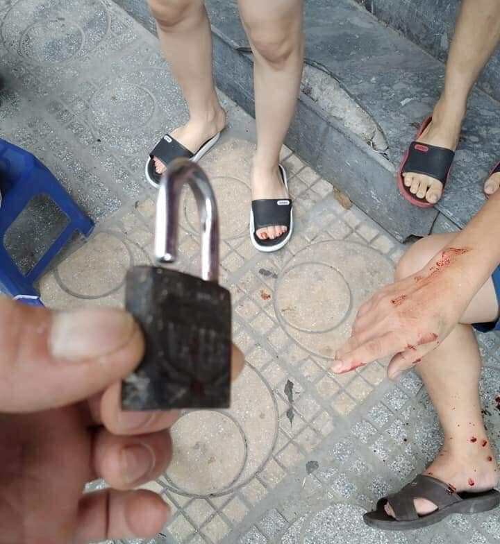 Hà Nội: Đưa cháu xuống chơi ở sân chung cư, người ông bị ổ khóa rơi trúng đầu gây thương tích-2