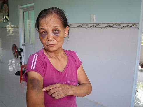 Cái kết bi thảm của người phụ nữ gãy gánh bỗng được trai tơ quan tâm-1