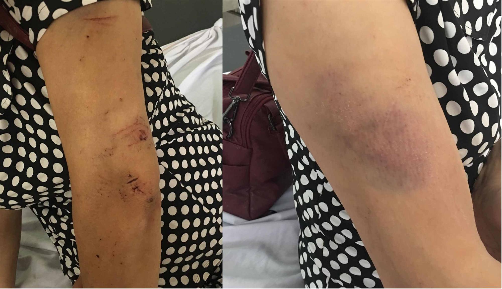 Lật xe khách ở Quảng Ninh 21 khách du lịch gặp nạn: Từ chuyến đi chơi thành đại tang-2