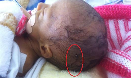 Những trẻ chào đời bị rách mặt, gãy chân tay do lỗi bác sĩ khiến các mẹ bầu hết hồn, nhiều trường hợp bác sĩ giải thích khó nghe-1