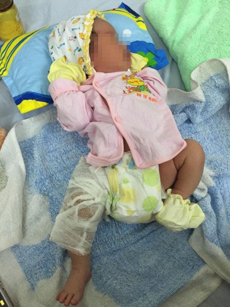 Những trẻ chào đời bị rách mặt, gãy chân tay do lỗi bác sĩ khiến các mẹ bầu hết hồn, nhiều trường hợp bác sĩ giải thích khó nghe-2