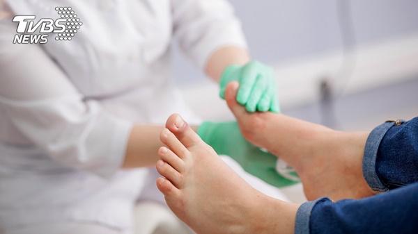 Cô gái bị nổi mụn cóc đầy ở trán chỉ vì dùng chung một vài vật dụng với chị gái: Khuyến cáo chị em đừng bao giờ làm theo-3