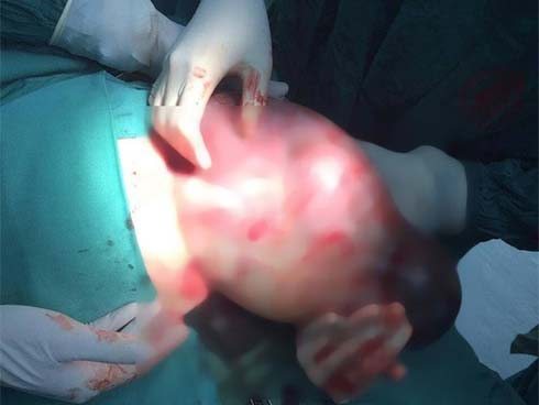 Mẹ vừa mới mất vì ung thư, bố đã hiếp dâm con gái ruột 14 tuổi đến sinh con-2