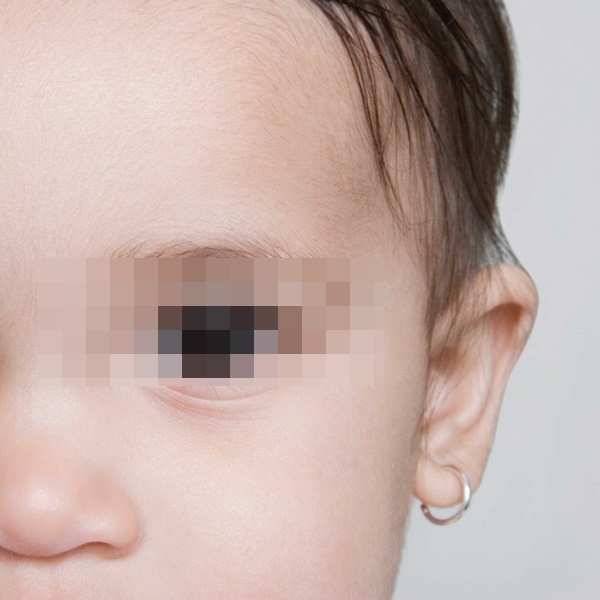 Đã có trẻ suýt chết do bấm lỗ tai, chuyên gia nhắc cha mẹ đừng quên điều này trước khi muốn làm đẹp cho con-2